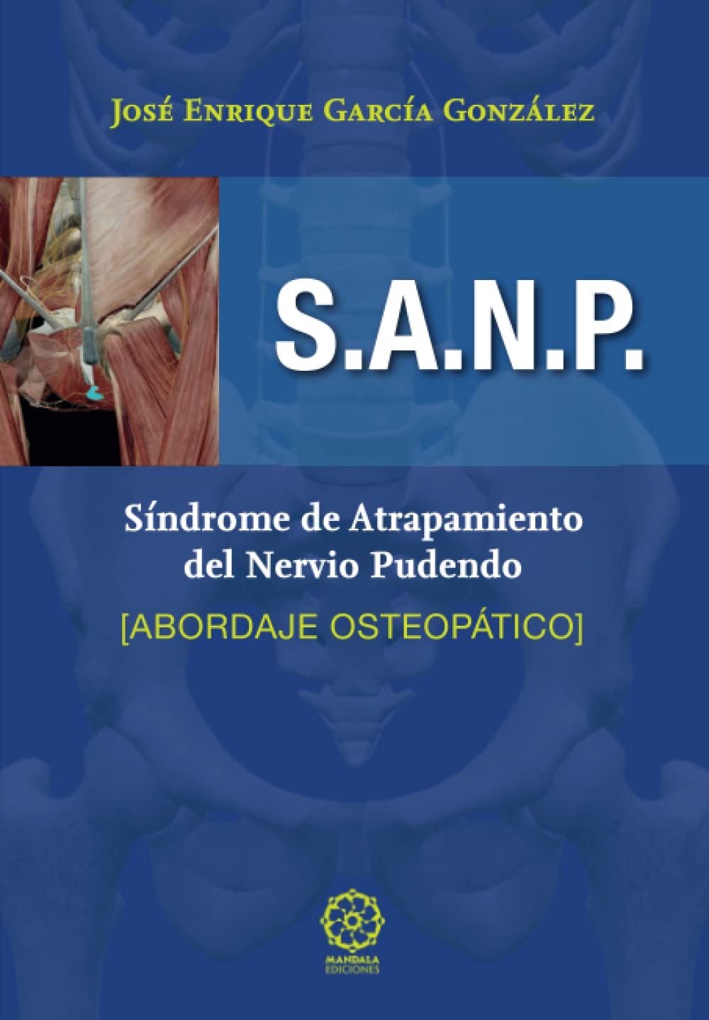 S.A.N.P. Síndrome de atrapamiento del nervio pudendo. Abordaje osteopático: Abordaje osteopático